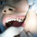Common Kid’s Dental Problems and How to Prevent Them