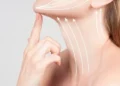 How Can a Neck Lift in Dubai Help You Look Younger Without Changing Your Natural Features?